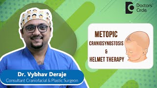 Triangular Forehead | Metopic Synostosis &amp; Helmet Therapy #baby - Dr.Vybhav Deraje | Doctors&#39; Circle