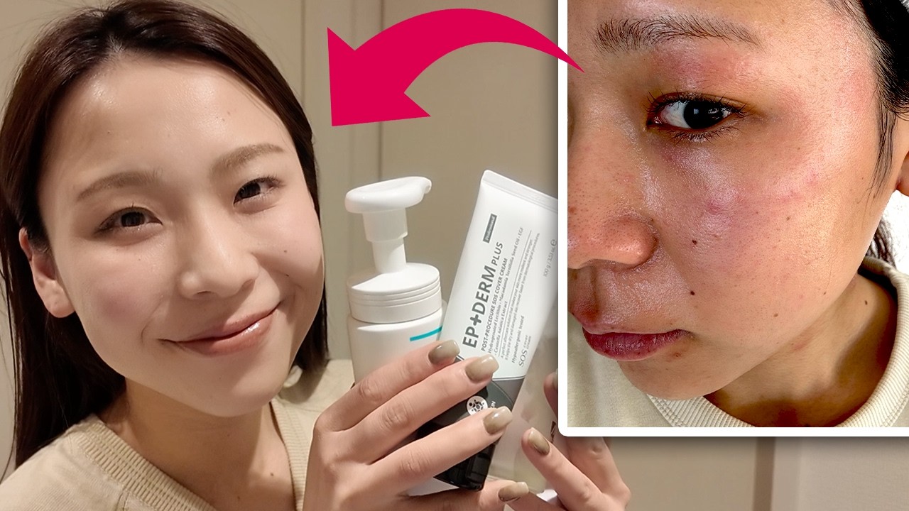 【絶望肌から大逆転】守りのスキンケア紹介｜乾燥肌・敏感肌・アトピー