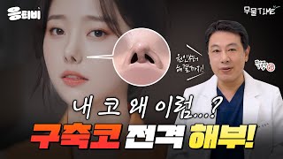 [무.물] 내 코 외 이럼? ‘구축코’ 전격 해부｜1%성형외과  #김종구 #코수술 #코재수술