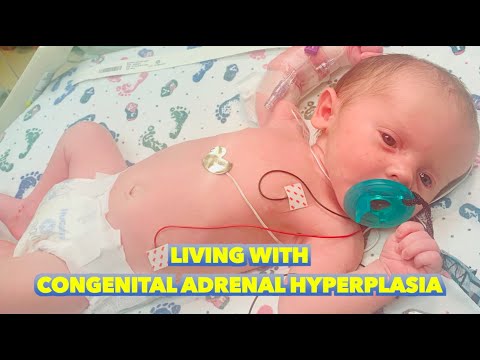 Living with Congenital Adrenal Hyperplasia (1 in Every 18,000 Diagnosed)