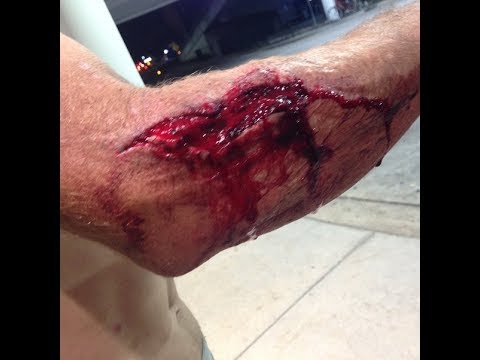 Metsolan Metsäkoulu 46, Moottorisahatyön turvallisuus