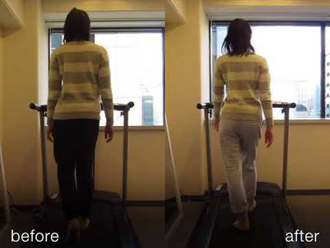 先天性股関節脱臼の施術事例  股関節痛の「保存施術」 ginzaplus