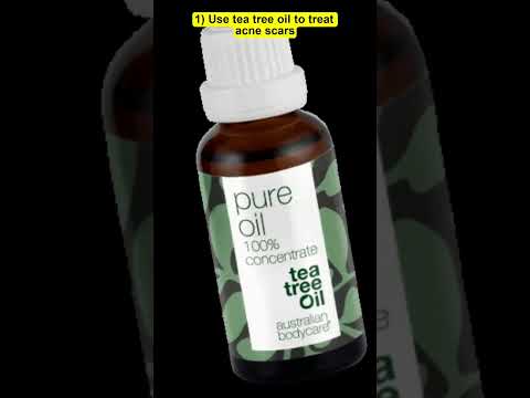 4 Natural Methods to Get Rid of Pimples Quickly | Eduaz