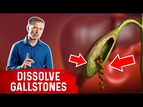 Do This to Help Dissolve Gallstones