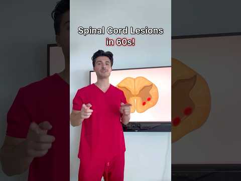 Spinal Cord Lesions in 60s from my #neurology Guide 🧠📘#medstudent  #medschool #usmle #usmlestep1