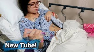 Feeding Tube Replacement: Fixing the Kinks! 👊 (10/23/17)