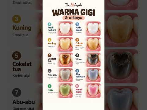 Warna Gigi Berubah? Jangan Langsung Menebak Penyebabnya #ibudanayah