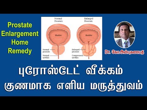 Chronic prostatitis treatment duration