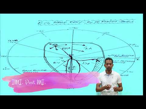 Electrical Rotation of Heart ECG MADE EASY Part 5