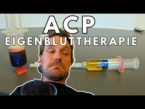 ACP autologous blood therapy for the patellar tendon - the first session