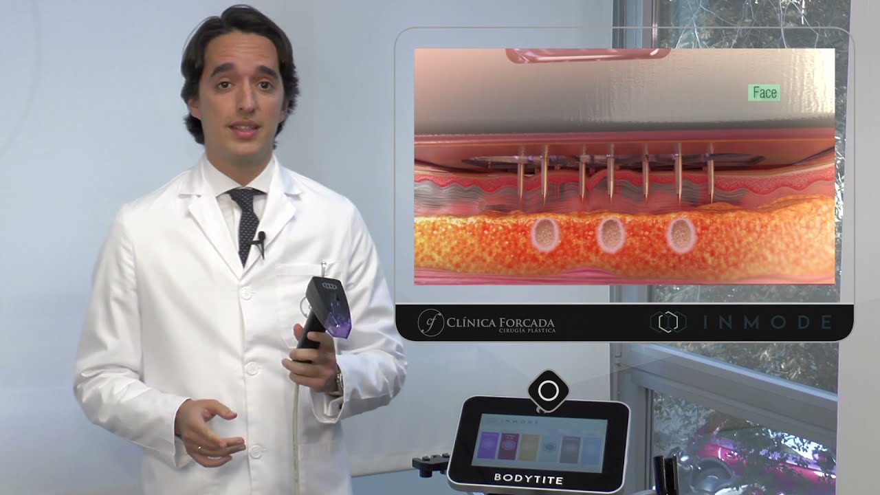 Eduardo Forcada Melero-20