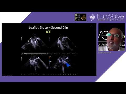 15H45 Symposium Siemens