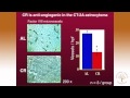 AHS12 Thomas Seyfried PhD Targeting Energy Metabolism In Brain Cancer