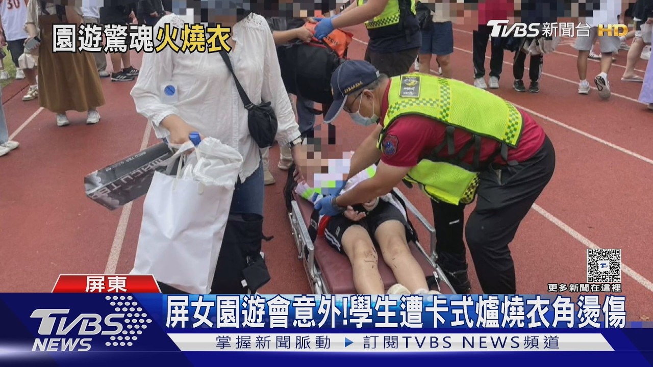 影音/屏女園遊會意外!高二生遭卡式爐燒衣角 腹部18%燙傷
