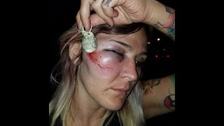 Woman Shot in the Face by Police with Bean Bag at El Cajon Protest