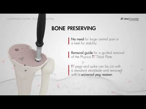 B-0079-23-000-2_052300_VST_CEMENTLESS-IS-MORE_EN