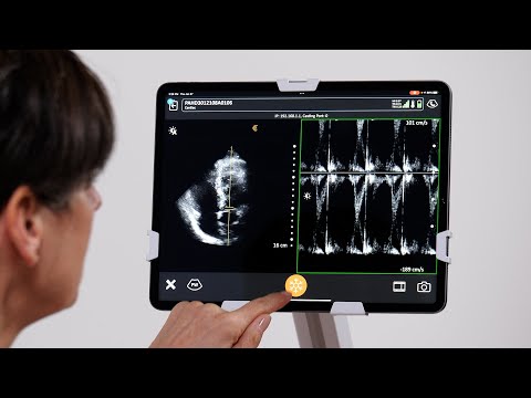 Pulsed Wave (PW) Doppler