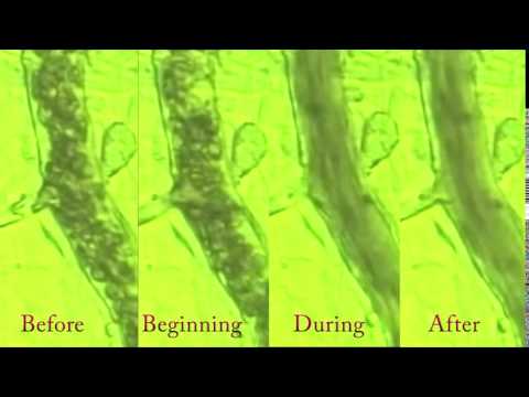 14 Seconds MUST SEE! Blood Flow in Real Time Before and After BEMER!