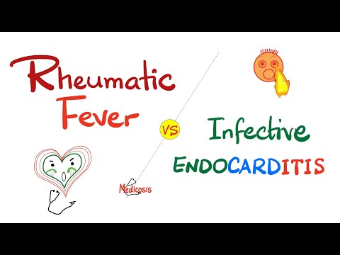 Rheumatic Fever vs. Infective Endocarditis - Comparison - Cardiology Series