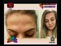 nugasewana-ayurveda-doctor-segment-21-06-2019