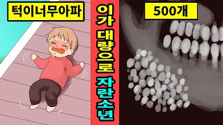 [인도실화]턱이 부어서 병원에 가니 치아가 500개나 자라있었던 소년?![만화][영상툰]