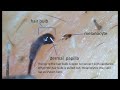 Black Bulb At End Of Eyebrow Hair