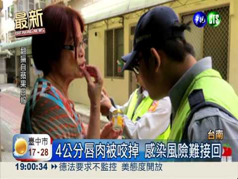 看門狗發狂! 一口咬下女嘴唇