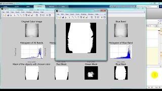 Bone Fractures detection using Matlab Code |Top 5 matlab projects