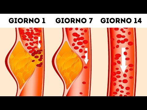 Incisione del ginocchio Applicatore e mal di schiena