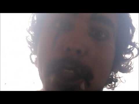 Malsano Contador -  Loco