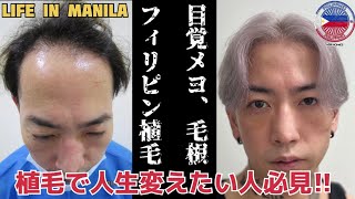 遂に始動!フィリピン植毛サポートプロジェクト!
