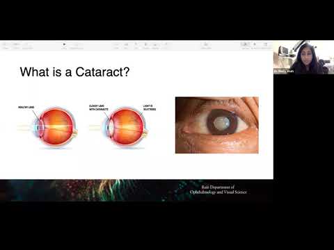 Keeping Your Eyes Healthy: Cataracts and Glaucoma