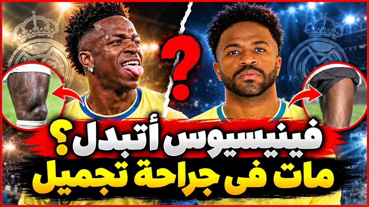 هل تم تبديل فينسيوس ؟ .. فيني الاصلي مات فى عملية تجميل !!