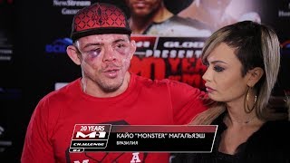 Кайо Магальяэш: Есть подозрения на перелом ноги, но проиграл по делу
