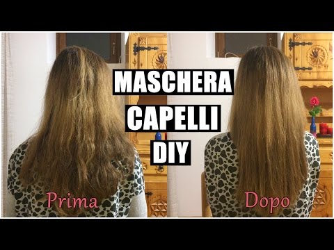 Calvizie di 17 anni alluomo Calvizie e lotta contro esso
