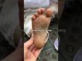 Don T Let Your Kids Go BAREFOOT