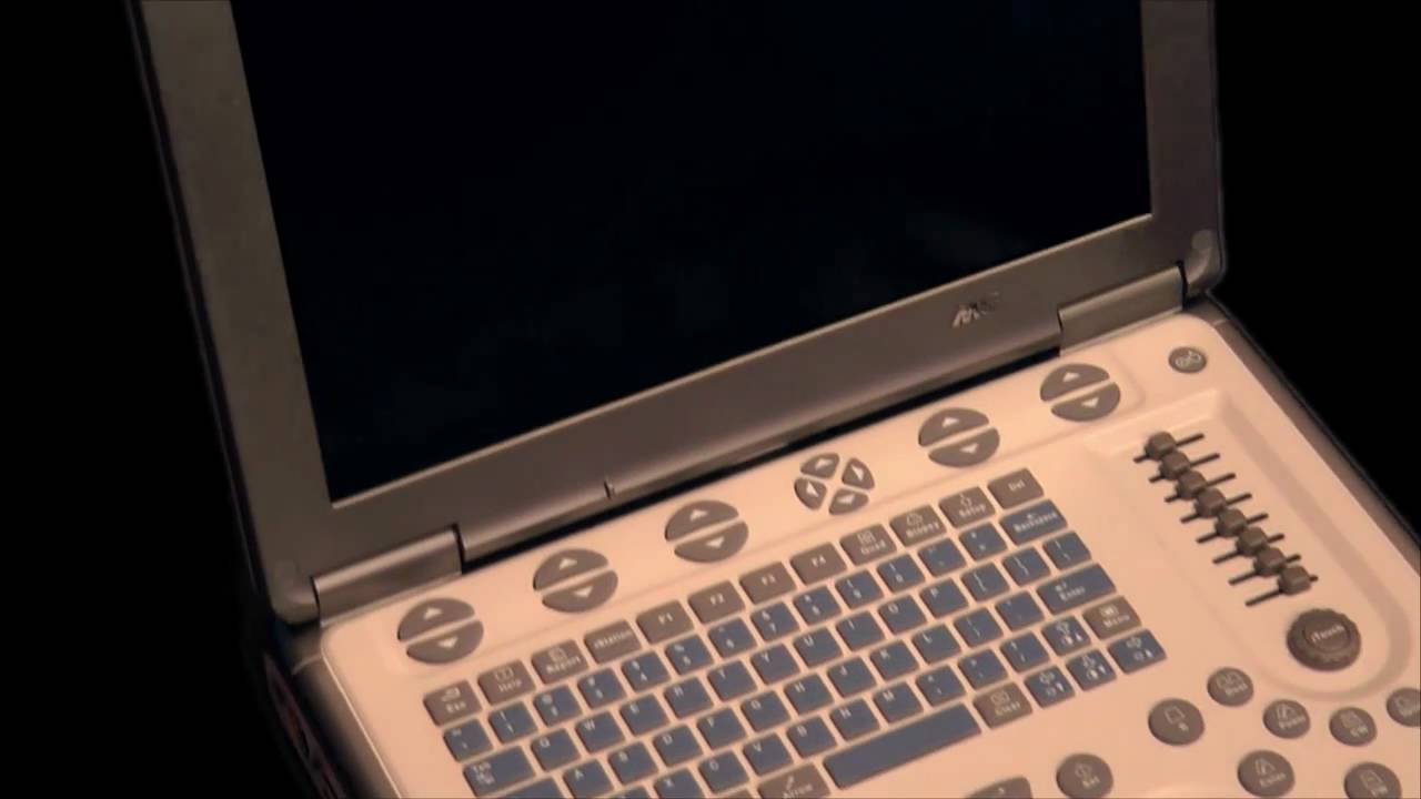 Mindray M5 Portable Ultrasound Machine video thumbnail