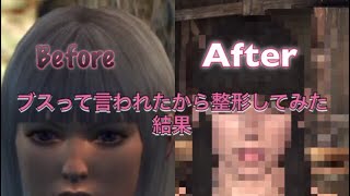 ブスって言われたから整形してみた結果【ドグマ】