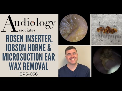ROSEN INSERTER, JOBSON HORNE & MICROSUCTION EAR WAX REMOVAL - EP666