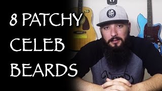 8 Patchy Celebrity Beards
