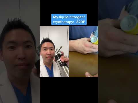 #shorts Dermatologist Reacting to Freeze-Away Wart Treatment