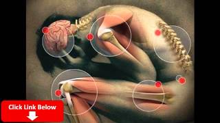 preview picture of video 'pengobatan penyakit demam rematik'