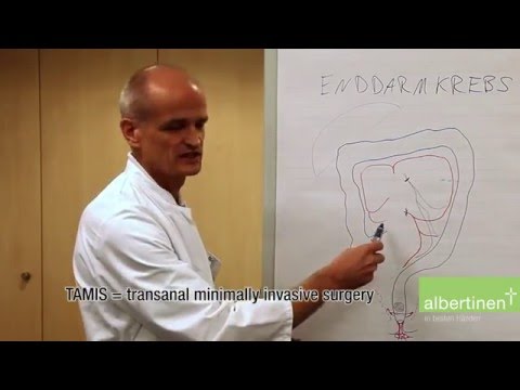 Kegel wachsen an den Knöcheln Kinder Vitamine für Knochen und Gelenke
