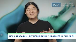 Craniosynostosis Explained: How UCLA Research Could Reduce Skull Surgeries in Children | Miranda Sun