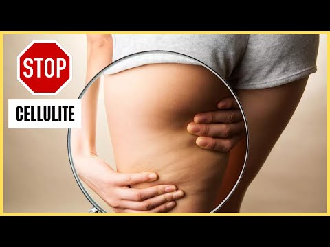 TESMED anti-cellulite : arnaque ou miracle ?