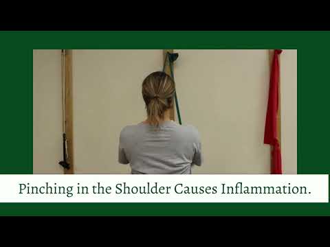 Shoulder Impingement