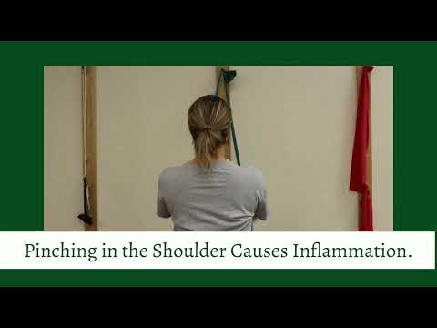 Shoulder Impingement
