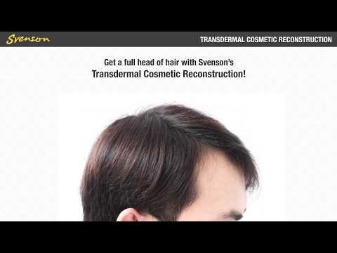 Natural-Looking Hair Replacement Only at Svenson