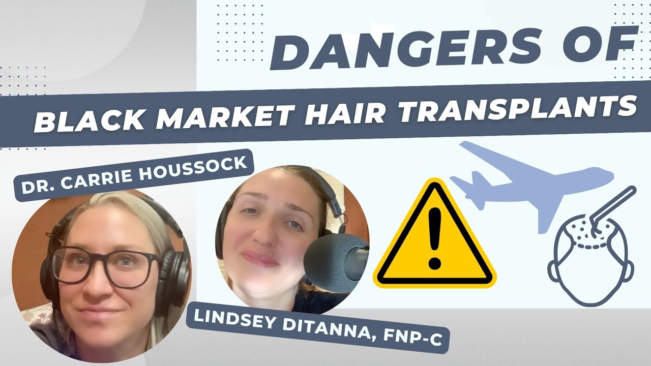 The Dark Side of Hair Transplant Surgery