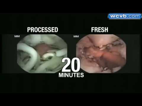 VIRAL Health Alert: Processed Ramen Noodles Effect In Stomach